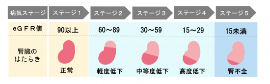 表